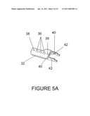 Spinous process fixation plate and minimally invasive method for placement diagram and image