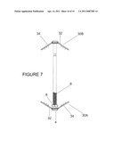 Spinous process fixation plate and minimally invasive method for placement diagram and image