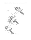 Rod-to-Rod Connector diagram and image