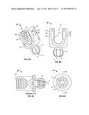 Rod-to-Rod Connector diagram and image