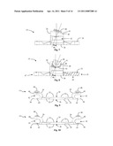 Surgical Fixation System and Related Methods diagram and image