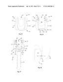 Surgical Fixation System and Related Methods diagram and image