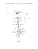 Surgical Fixation System and Related Methods diagram and image