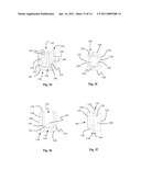 Surgical Fixation System and Related Methods diagram and image