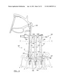 Deformable Device For Minimally Invasive Fixation diagram and image