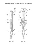 Deformable Device For Minimally Invasive Fixation diagram and image