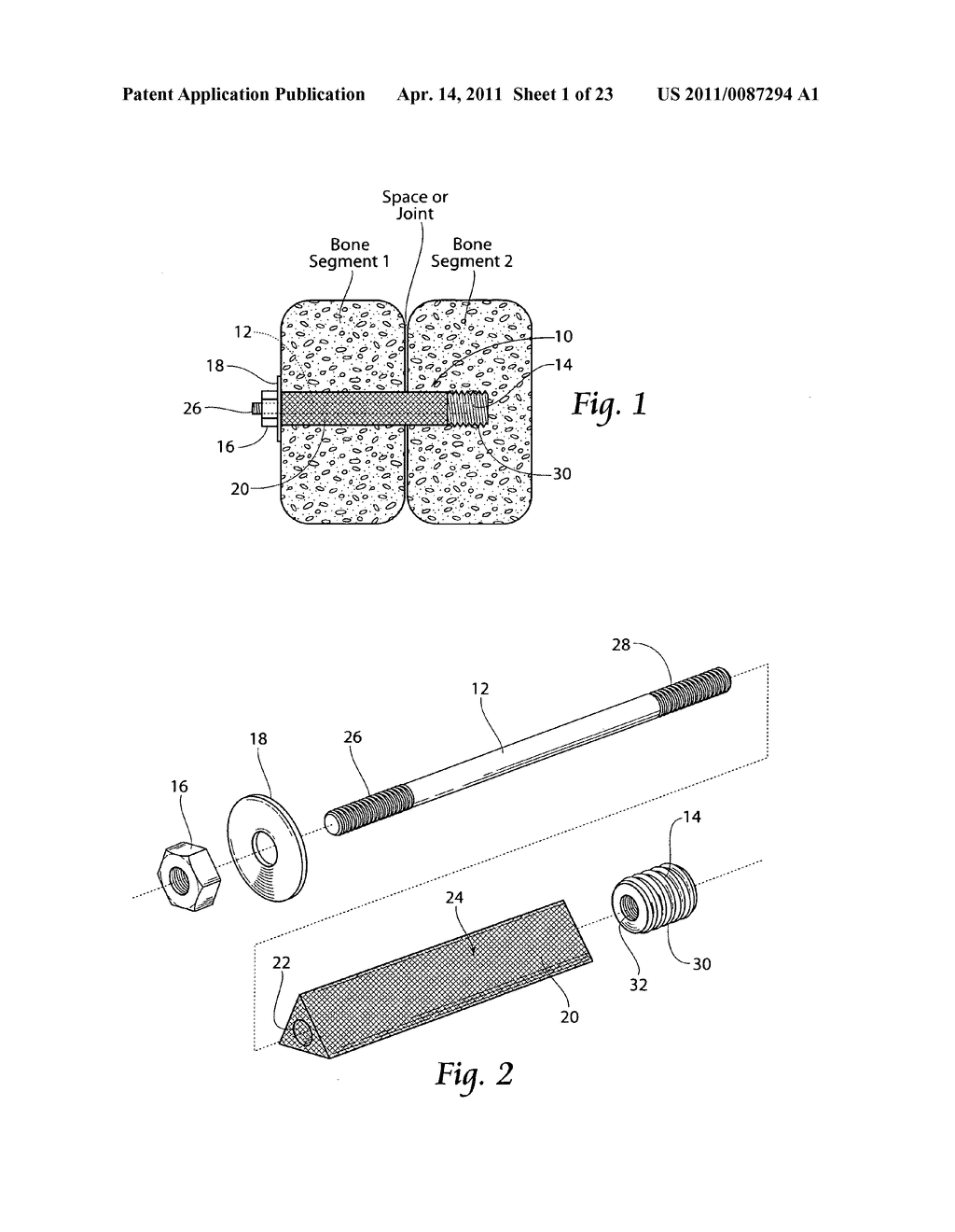 Systems and methods for the fusion of the sacral-iliac joint - diagram, schematic, and image 02