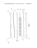 Implantable Interface for a Medical Device System diagram and image