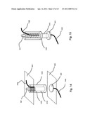 Implantable Interface for a Medical Device System diagram and image