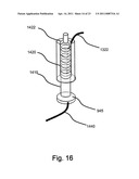 Implantable Interface for a Medical Device System diagram and image