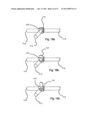 Implantable Interface for a Medical Device System diagram and image