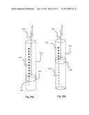 Implantable Interface for a Medical Device System diagram and image