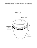 Apparatus for Mitral Lifting Annuloplaty diagram and image