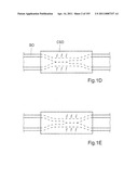 APPARATUS FOR CONTROLLING FLOW IN A BODILY ORGAN diagram and image