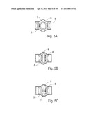 APPARATUS FOR CONTROLLING FLOW IN A BODILY ORGAN diagram and image