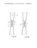 APPARATUS FOR CONTROLLING FLOW IN A BODILY ORGAN diagram and image