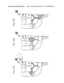 APPARATUS FOR CONTROLLING FLOW IN A BODILY ORGAN diagram and image