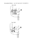 APPARATUS FOR CONTROLLING FLOW IN A BODILY ORGAN diagram and image