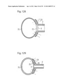 APPARATUS FOR CONTROLLING FLOW IN A BODILY ORGAN diagram and image