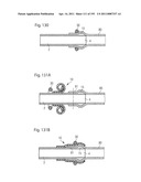 APPARATUS FOR CONTROLLING FLOW IN A BODILY ORGAN diagram and image