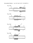 APPARATUS FOR CONTROLLING FLOW IN A BODILY ORGAN diagram and image