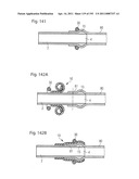 APPARATUS FOR CONTROLLING FLOW IN A BODILY ORGAN diagram and image