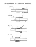 APPARATUS FOR CONTROLLING FLOW IN A BODILY ORGAN diagram and image