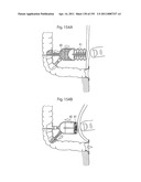 APPARATUS FOR CONTROLLING FLOW IN A BODILY ORGAN diagram and image