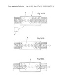 APPARATUS FOR CONTROLLING FLOW IN A BODILY ORGAN diagram and image