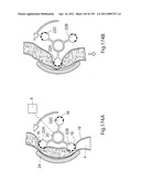 APPARATUS FOR CONTROLLING FLOW IN A BODILY ORGAN diagram and image