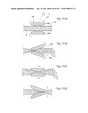 APPARATUS FOR CONTROLLING FLOW IN A BODILY ORGAN diagram and image