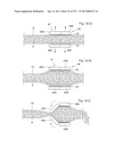 APPARATUS FOR CONTROLLING FLOW IN A BODILY ORGAN diagram and image