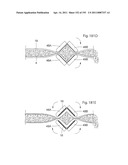 APPARATUS FOR CONTROLLING FLOW IN A BODILY ORGAN diagram and image