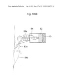 APPARATUS FOR CONTROLLING FLOW IN A BODILY ORGAN diagram and image