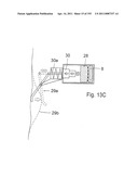 APPARATUS FOR CONTROLLING FLOW IN A BODILY ORGAN diagram and image