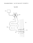 APPARATUS FOR CONTROLLING FLOW IN A BODILY ORGAN diagram and image