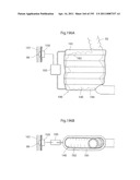 APPARATUS FOR CONTROLLING FLOW IN A BODILY ORGAN diagram and image