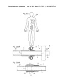 APPARATUS FOR CONTROLLING FLOW IN A BODILY ORGAN diagram and image