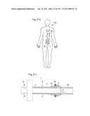 APPARATUS FOR CONTROLLING FLOW IN A BODILY ORGAN diagram and image