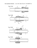 APPARATUS FOR CONTROLLING FLOW IN A BODILY ORGAN diagram and image