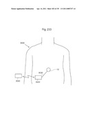 APPARATUS FOR CONTROLLING FLOW IN A BODILY ORGAN diagram and image