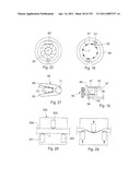 APPARATUS FOR CONTROLLING FLOW IN A BODILY ORGAN diagram and image