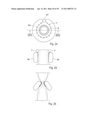 APPARATUS FOR CONTROLLING FLOW IN A BODILY ORGAN diagram and image