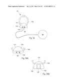 APPARATUS FOR CONTROLLING FLOW IN A BODILY ORGAN diagram and image