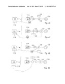 APPARATUS FOR CONTROLLING FLOW IN A BODILY ORGAN diagram and image