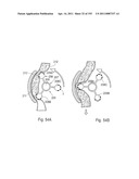 APPARATUS FOR CONTROLLING FLOW IN A BODILY ORGAN diagram and image