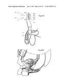 APPARATUS FOR CONTROLLING FLOW IN A BODILY ORGAN diagram and image