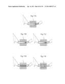 APPARATUS FOR CONTROLLING FLOW IN A BODILY ORGAN diagram and image