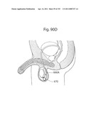 APPARATUS FOR CONTROLLING FLOW IN A BODILY ORGAN diagram and image