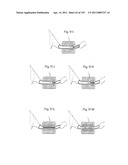 APPARATUS FOR CONTROLLING FLOW IN A BODILY ORGAN diagram and image